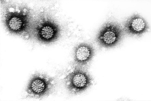 Humán papillómavírus